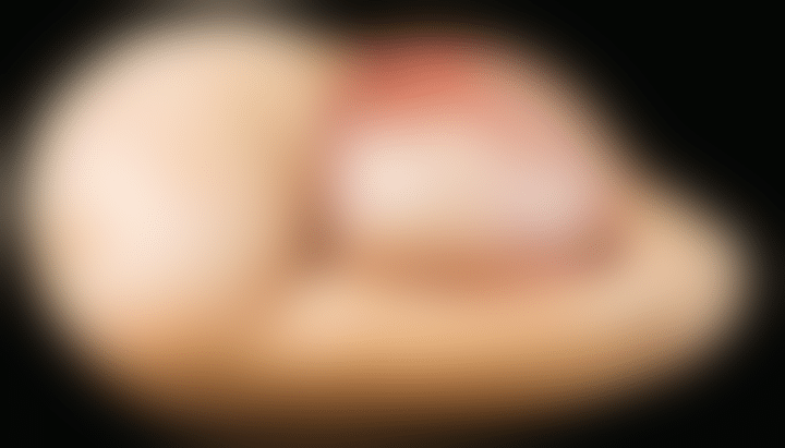 découvrez si les chiens ont vraiment un nombril ! explorez la vérité surprenante sur l’anatomie canine, expliquée simplement pour satisfaire votre curiosité.